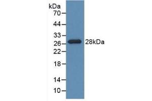 Detection of Recombinant PDXK, Rat using Polyclonal Antibody to Pyridoxal Kinase (PDXK) (PDXK anticorps  (AA 35-251))