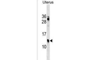KLKP1 Antibody (N-term) (ABIN1538887 and ABIN2850264) western blot analysis in Uterus tissue lysates (35 μg/lane). (KLKP1 anticorps  (N-Term))
