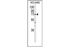 Western blot analysis of DDX17 Antibody (N-term) in NCI-H460 cell line lysates (35ug/lane). (DDX17 anticorps  (N-Term))