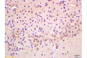 Formalin-fixed and paraffin embedded rat brain labeled with Anti-RAD21 Polyclonal Antibody, Unconjugated (ABIN706391) at 1:200 followed by conjugation to the secondary antibody and DAB staining. (RAD21 anticorps  (AA 531-631))
