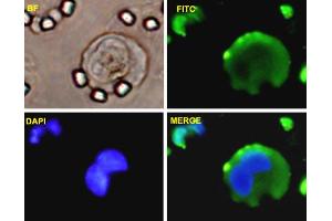 A-549 cells were stained with VIM-FITC labeled monoclonal antibody (Green).
