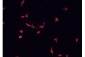 ABIN6266946 staining HepG2  cells by IF/ICC. (CDKL4 anticorps  (Internal Region))