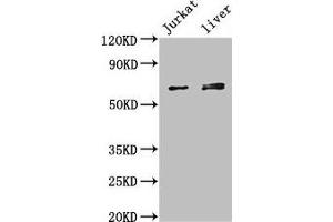 Western Blot Positive WB detected in: Jurkat whole cell lysate, Mouse liver tissue All lanes: KLHL2 antibody at 3 μg/mL Secondary Goat polyclonal to rabbit IgG at 1/50000 dilution Predicted band size: 66, 67, 57 kDa Observed band size: 66, 67 kDa (KLHL2 anticorps  (AA 1-155))