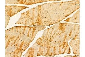 ABIN7094230 and ABIN7098277 at 1/100 staining Mouse muscle tissue by IHC-P. (FERMT1 anticorps  (Internal Region))