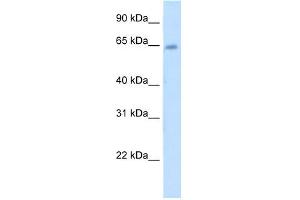 WB Suggested Anti-STS Antibody Titration:  5. (STS anticorps  (C-Term))