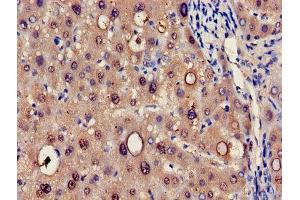 Immunohistochemistry of paraffin-embedded human liver tissue using ABIN7142154 at dilution of 1:100 (HRSP12 anticorps  (AA 2-137))