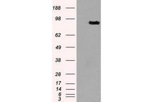 HEK293T cells were transfected with the pCMV6-ENTRY control (Left lane) or pCMV6-ENTRY PROM2 (Right lane) cDNA for 48 hrs and lysed. (Prominin 2 anticorps)