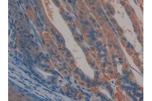 Detection of ALCAM in Mouse Stomach Tissue using Polyclonal Antibody to Activated Leukocyte Cell Adhesion Molecule (ALCAM)