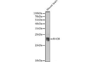 Western blot analysis of extracts of Mouse brain using RHOB Polyclonal Antibody at dilution of 1:1000. (RHOB anticorps)