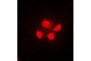 Immunofluorescent analysis of TUG staining in A549 cells.