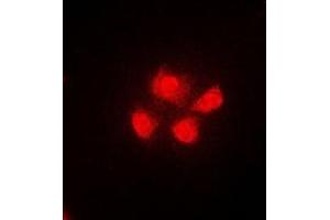 Immunofluorescent analysis of TUG staining in A549 cells.