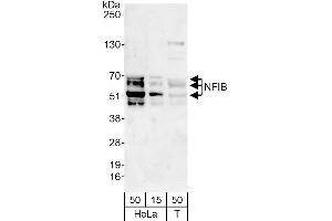 anti-Nuclear Factor I/B (NFIB) (AA 325-375) antibody