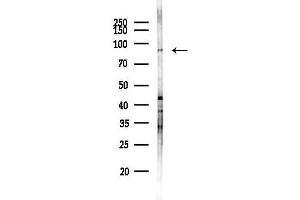 anti-Two Pore Segment Channel 1 (TPCN1) antibody