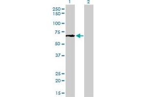 Western Blot analysis of GCLC expression in transfected 293T cell line by GCLC monoclonal antibody (M01), clone 3H1.