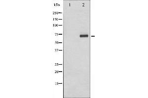 Western blot analysis of Tyrosinase expression in COS7 cells. (TYR anticorps)