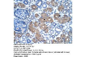 Rabbit Anti-ASS Antibody  Paraffin Embedded Tissue: Human Kidney Cellular Data: Epithelial cells of renal tubule Antibody Concentration: 4.