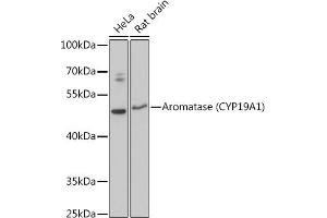Western blot analysis of extracts of various cell lines, using Aromatase (CYP19) antibody (2684) at 1:3000 dilution. (Aromatase anticorps  (AA 1-180))