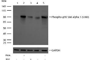 All lanes : Phospho-p90 S6K alpha 1 (S380) Rabbit mAb at 1/1k dilution Lane 1 : Hela whole cell lysates Lane 2 : Hela treated with 200nM PMA for 30 min whole cell lysates Lane 3 :Hela treated with 100 ng/mL EGF for 20 min whole cell lysates Lane 4 : JK whole cell lysates Lane 5 : JK treated with 200nM PMA for 30 min whole cell lysates Lysates/proteins at 20 μg per lane.