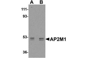 Western Blotting (WB) image for anti-Adaptor-Related Protein Complex 2, mu 1 Subunit (AP2M1) (C-Term) antibody (ABIN1030240)