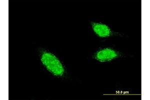 Immunofluorescence of monoclonal antibody to BLID on HeLa cell. (BLID anticorps  (AA 2-108))
