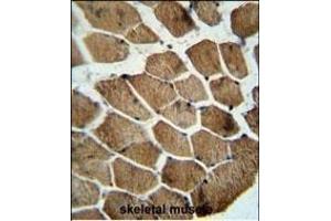 MOCS1 antibody (C-term) (ABIN654212 and ABIN2844052) immunohistochemistry analysis in formalin fixed and paraffin embedded human skeletal muscle followed by peroxidase conjugation of the secondary antibody and DAB staining.