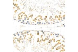 Immunohistochemistry analysis of paraffin-embedded rat testis using Torsin A (ABIN7075942) at dilution of 1: 800