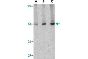 Western blot analysis of CRLF2 in human liver tissue lysate with CRLF2 polyclonal antibody  at (A) 0. (CRLF2 anticorps  (Internal Region))