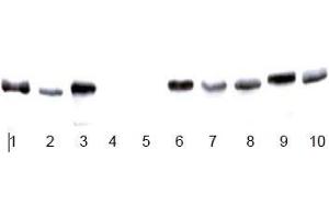 Image no. 4 for anti-Glyceraldehyde-3-Phosphate Dehydrogenase (GAPDH) antibody (ABIN284439) (GAPDH anticorps)