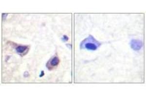 Immunohistochemistry analysis of paraffin-embedded human brain tissue using JAK3 (Ab-785) antiobdy. (JAK3 anticorps  (Tyr785))
