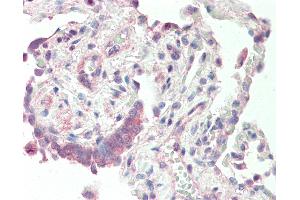 Human, Lung: Formalin-Fixed Paraffin-Embedded (FFPE).