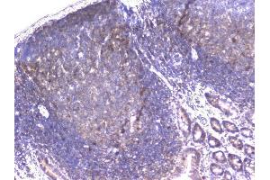 IHC analysis of PPID using anti-PPID antibody (ABIN6719438). (PPID anticorps  (AA 306-370))