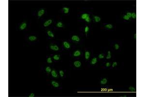 Immunofluorescence of monoclonal antibody to TBL1XR1 on HeLa cell. (TBL1XR1 anticorps  (AA 81-178))