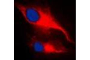 Immunofluorescent analysis of LCK (pY393) staining in MCF7 cells.