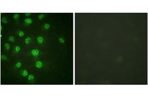 Immunofluorescence analysis of HuvEc cells treated with serum 20% 30', using p57 Kip2 (Phospho-Thr310) Antibody. (CDKN1C anticorps  (pThr310))