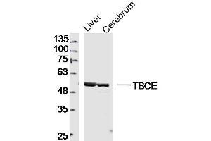 Lane 1: mouse iver lysates Lane 2: mouse cererum lysates probed with TBCE Polyclonal Antibody, Unconjugated  at 1:300 dilution and 4˚C overnight incubation. (TBCE anticorps  (AA 1-100))