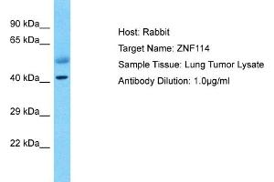 Host: Rabbit Target Name: ZNF114 Sample Type: Lung Tumor lysates Antibody Dilution: 1. (ZNF114 anticorps  (C-Term))