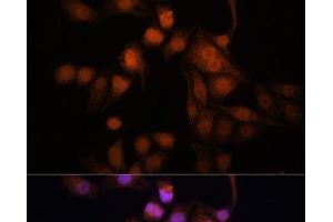 Immunofluorescence analysis of HeLa cells using Twist Polyclonal Antibody at dilution of 1:100. (TWIST1 anticorps)