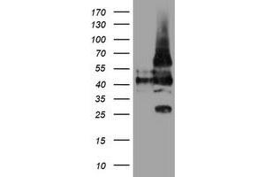 Western Blotting (WB) image for anti-Leucine Rich Repeat Containing 25 (LRRC25) antibody (ABIN1499199) (LRRC25 anticorps)