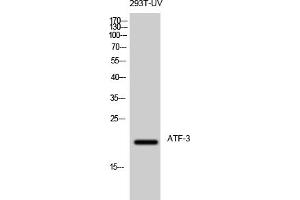 Western Blot analysis of 293T-UV cells using ATF-3 Polyclonal Antibody diluted at 1:500.