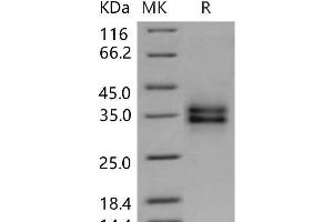 Western Blotting (WB) image for Folate Receptor 1 (Adult) (FOLR1) (AA 1-231) protein (His tag) (ABIN7320227)