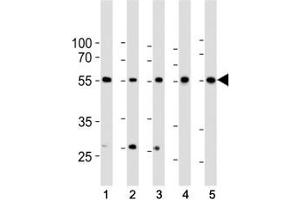 Western blot analysis of lysate from 1) HeLa, 2) K562, 3) MCF-7 cell line, 4) human liver and 5) mouse liver tissue lysate using BMPR1A antibody at 1:1000. (BMPR1A anticorps  (AA 1-30))