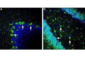 Expression of Glucose Transporter 2 in rat cerebellum and hippocampus - Immunohistochemical staining of perfusion-fixed frozen rat brain sections using Anti-GLUT2 (SLC2A2) Antibody (ABIN7043694, ABIN7044483 and ABIN7044484), (1:120), followed by goat-anti-rabbit-AlexaFluor-488 (green).