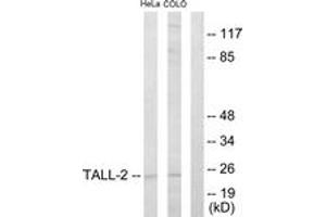 Western blot analysis of extracts from HeLa/COLO205 cells, using TALL-2 Antibody.