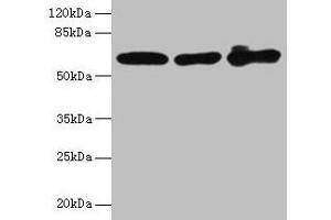 Western blot All lanes: KRT6A antibody at 4 μg/mL Lane 1: A431 whole cell lysate Lane 2: K562 whole cell lysate Lane 3: MCF-7 whole cell lysate Secondary Goat polyclonal to rabbit IgG at 1/10000 dilution Predicted band size: 61 kDa Observed band size: 61 kDa (KRT6A anticorps  (AA 2-564))