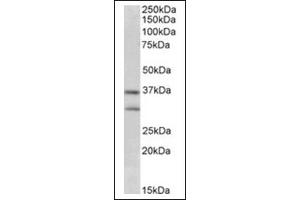 Image no. 1 for anti-Fibroblast Growth Factor 23 (FGF23) (Internal Region) antibody (ABIN375198) (FGF23 anticorps  (Internal Region))
