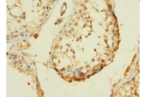 Immunohistochemistry of paraffin-embedded human testis tissue using ABIN7166755 at dilution of 1:100 (DHX32 anticorps  (AA 301-500))