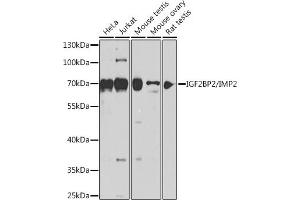 Western blot analysis of extracts of various cell lines, using IGF2BP2/IMP2 antibody (ABIN6134718, ABIN6142241, ABIN6142243 and ABIN6218347) at 1:1000 dilution. (IGF2BP2 anticorps  (C-Term))