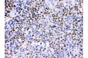 Anti- Ikaros Picoband antibody, IHC(P) IHC(P): Human Tonsil Tissue
