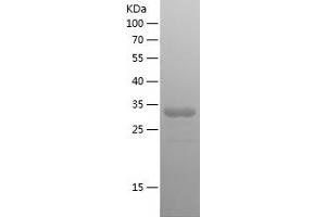 Western Blotting (WB) image for Collagen, Type VI, alpha 1 (COL6A1) (AA 728-1028) protein (His tag) (ABIN7122447)