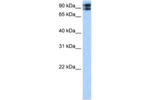 Western Blotting (WB) image for anti-C2CD2-Like (C2CD2L) antibody (ABIN2463042) (C2CD2L anticorps)